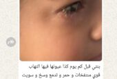 كحل اللبان