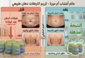 كريم شفط الدهون