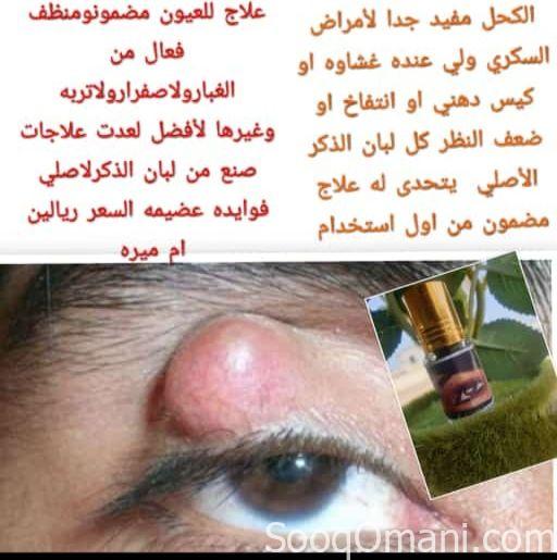 كحل اللبان