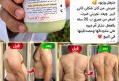 Fat-Suction Cream
